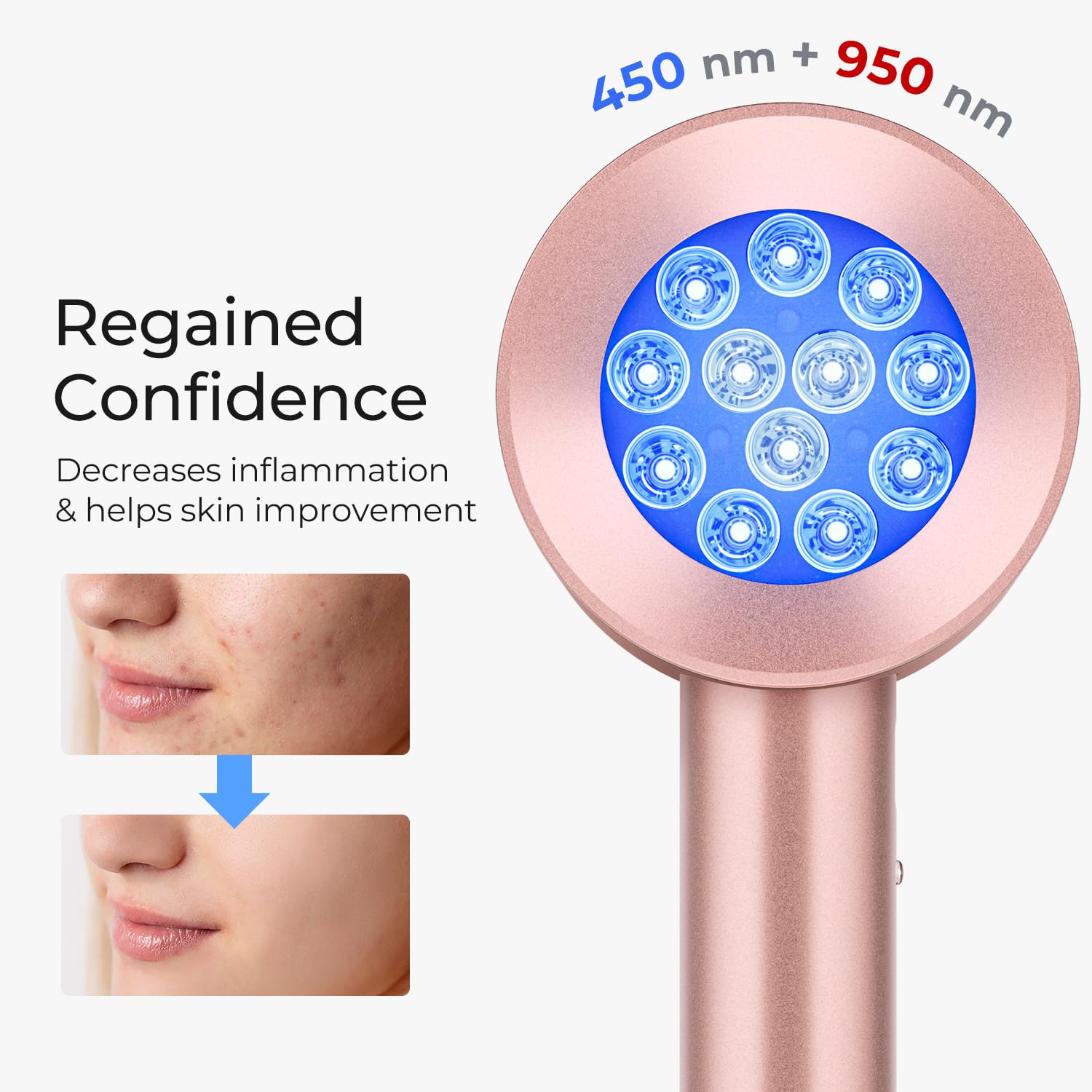 Skin Care Red Light Therapy An - Galvanic Skin Sensor review and price