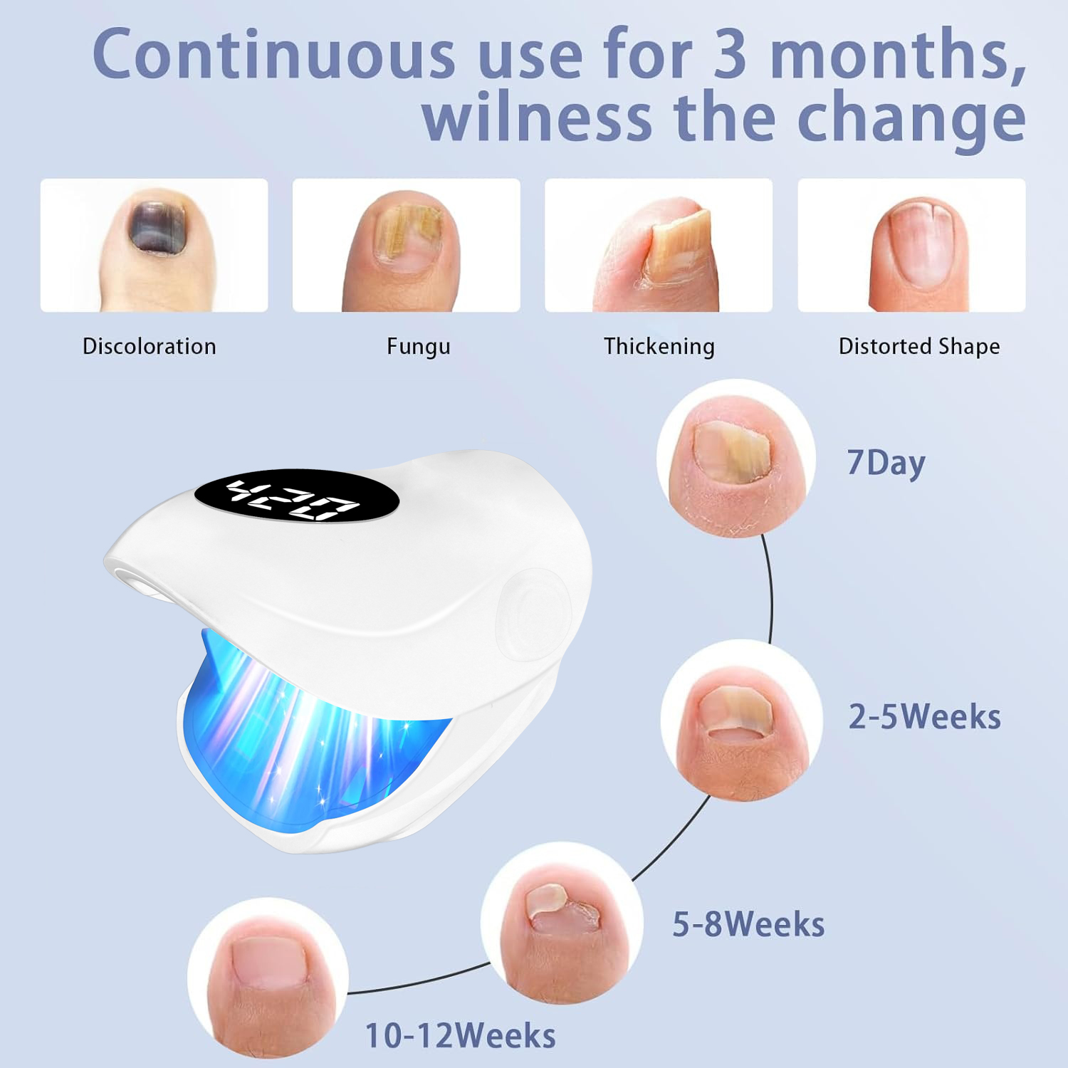 Nail Fungus Laser Device 500NM - Galvanic Skin Sensor review and price